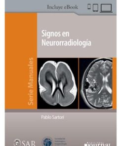 Signos en Neurorradiología 1 Edición