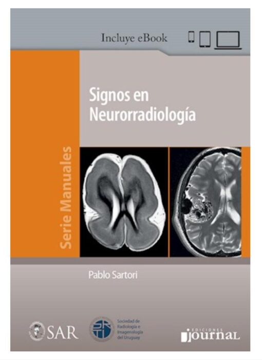 Signos en Neurorradiología 1 Edición Signos en Neurorradiología 1 Edición