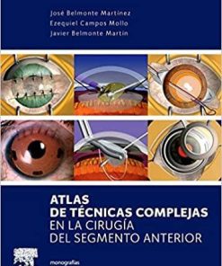 Atlas de técnicas complejas en la cirugía del segmento anterior (Spanish Edition)