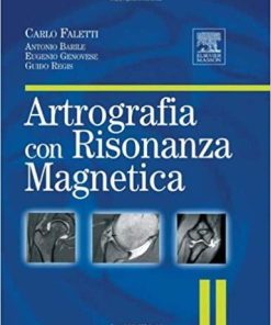 Artografia con risonanza magnetica