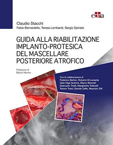 Guida alla riabilitazione implantoprotesica del mascellare posteriore atrofico (Italian Edition) Guida alla riabilitazione implantoprotesica del mascellare posteriore atrofico (Italian Edition)