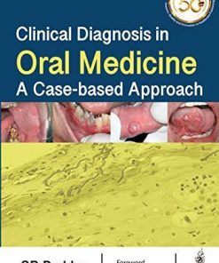Clinical Diagnosis in Oral Medicine: A Case-based Approach
