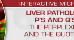 USCAP Liver Pathology P’s and Q’s: The Perplexing and the Quotidian	2022 (CME VIDEOS)