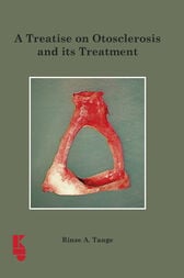 A Treatise on Otoslerosis and its Treatment (PDF)