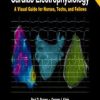 Cardiac Electrophysiology: A Visual Guide for Nurses, Techs, and Fellows, Second Edition (PDF)