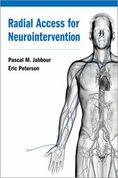 Radial Access for Neurointervention (PDF)