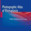 Photographic Atlas of Rhinoplasty (PDF)