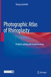 Photographic Atlas of Rhinoplasty (PDF)