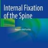 Internal Fixation of the Spine (PDF)