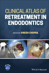 Clinical Atlas of Retreatment in Endodontics (EPUB)