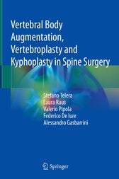 Vertebral Body Augmentation, Vertebroplasty and Kyphoplasty in Spine Surgery (PDF)