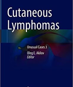 Cutaneous Lymphomas: Unusual Cases 3 (PDF)