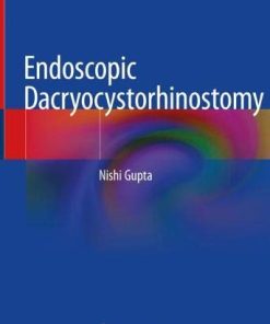 Endoscopic Dacryocystorhinostomy (PDF)