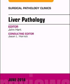 Liver Pathology, An Issue of Surgical Pathology Clinics (Volume 11-2) (The Clinics: Surgery (Volume 11-2)) (PDF)