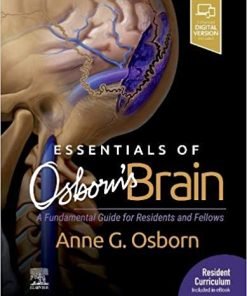 Essentials of Osborn’s Brain: A Fundamental Guide for Residents and Fellows (PDF)