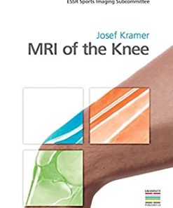 MRI of the Knee, 1st edition (PDF)