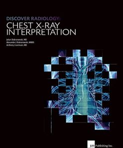 Discover Radiology Chest X-Ray Interpretation : Book for Medical Student (PDF)