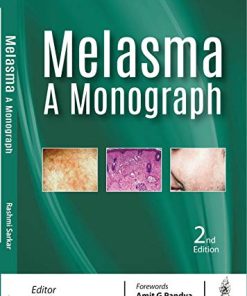 Melasma: A Monograph, 2nd Edition (PDF)