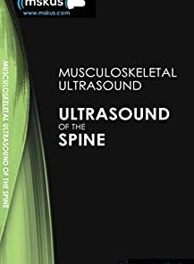 Ultrasound of the Spine, 2nd Edition (PDF)
