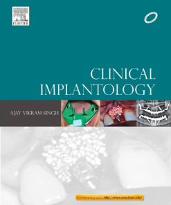 Clinical Implantology