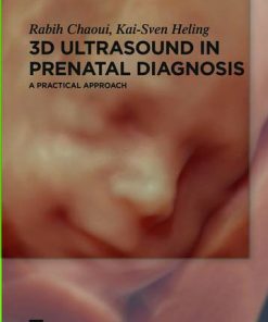 3D Ultrasound in Prenatal Diagnosis: A Practical Approach (PDF)