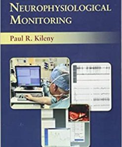 The Audiologist’s Handbook of Neurophysiological Monitoring (PDF)