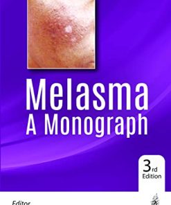 Melasma A Monograph, 3rd Edition (PDF)