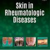 Skin In Rheumatologic Diseases (PDF)