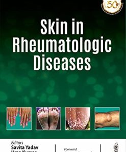 Skin In Rheumatologic Diseases (PDF)