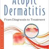 Atopic Dermatitis: From Diagnosis to Treatment (PDF)