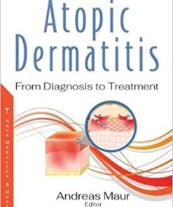 Atopic Dermatitis: From Diagnosis to Treatment (PDF)