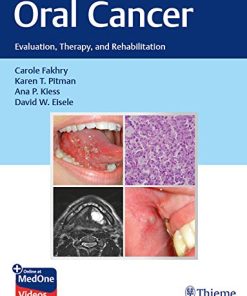 Oral Cancer: Evaluation, Therapy, and Rehabilitation (PDF)