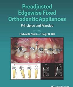 Preadjusted Edgewise Fixed Orthodontic Appliances: Principles and Practice (PDF)