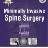 Minimally Invasive Spine Surgery (PDF) Minimally Invasive Spine Surgery (PDF)