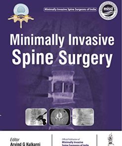 Minimally Invasive Spine Surgery (PDF)