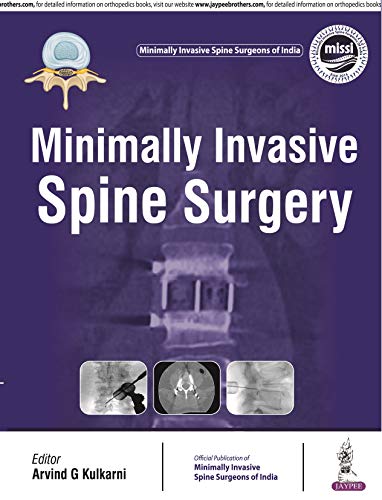 Minimally Invasive Spine Surgery (PDF) Minimally Invasive Spine Surgery (PDF)