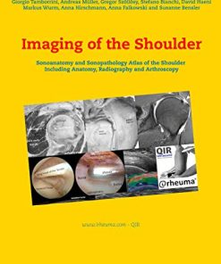 Imaging of the Shoulder: Sonoanatomy and Sonopathology Atlas of the Shoulder Including Anatomy, Radiography and Arthroscopy (ePub+Converted PDF)