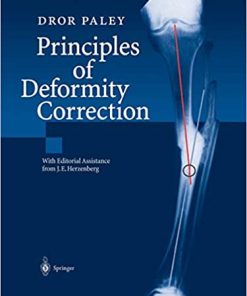 Principles of Deformity Correction (PDF)