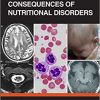 Neurological Consequences of Nutritional Disorders (PDF)