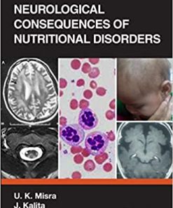 Neurological Consequences of Nutritional Disorders (PDF)