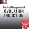 Practical Management of Ovulation Induction