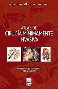 Atlas De Cirugia Minimamente Invasiva (Spanish Edition) (PDF)