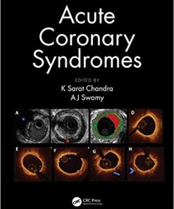 Acute Coronary Syndromes (PDF)