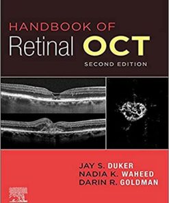 Handbook of Retinal OCT: Optical Coherence Tomography, 2nd Edition (PDF)