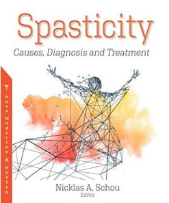 Spasticity: Causes, Diagnosis and Treatment (PDF)