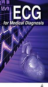 ECG for Medical Diagnosis (PDF)