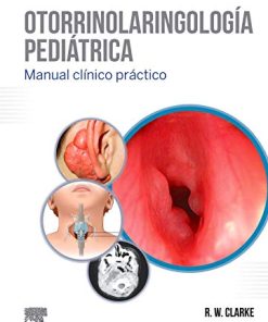 Otorrinolaringología pediátrica (PDF)