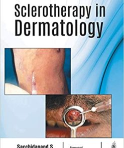 Sclerotherapy in Dermatology (PDF)