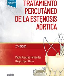 Manual de tratamiento percutáneo de la estenosis aórtica, 2nd edition (PDF)