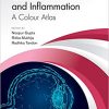 Corneal Infection and Inflammation: A Colour Atlas (EPUB & Converted PDF)